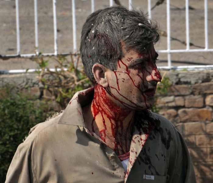 The walls and windows of the restaurant were blown up by the blast. The injured were taken to nearby hospitals.&nbsp;(AFP Photo)